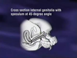 examination of the female genital organs (american educational video)