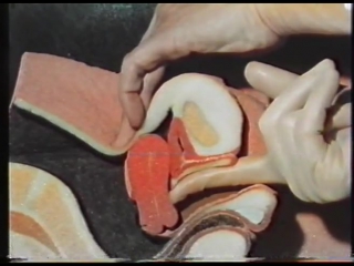 unique video of a gynecological examination (czechoslovakia, 1987)